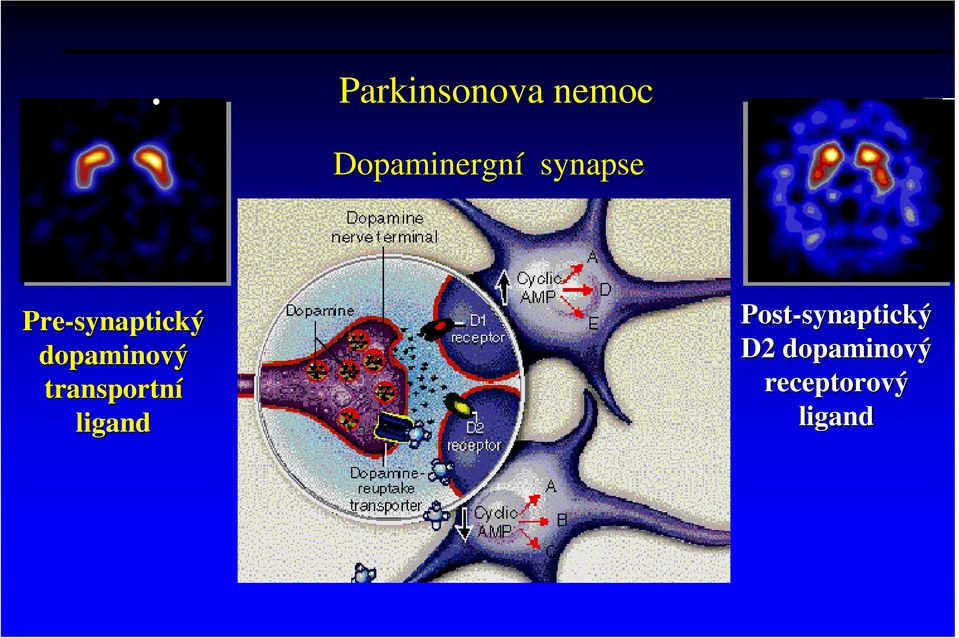 dopaminový ový transportní ligand
