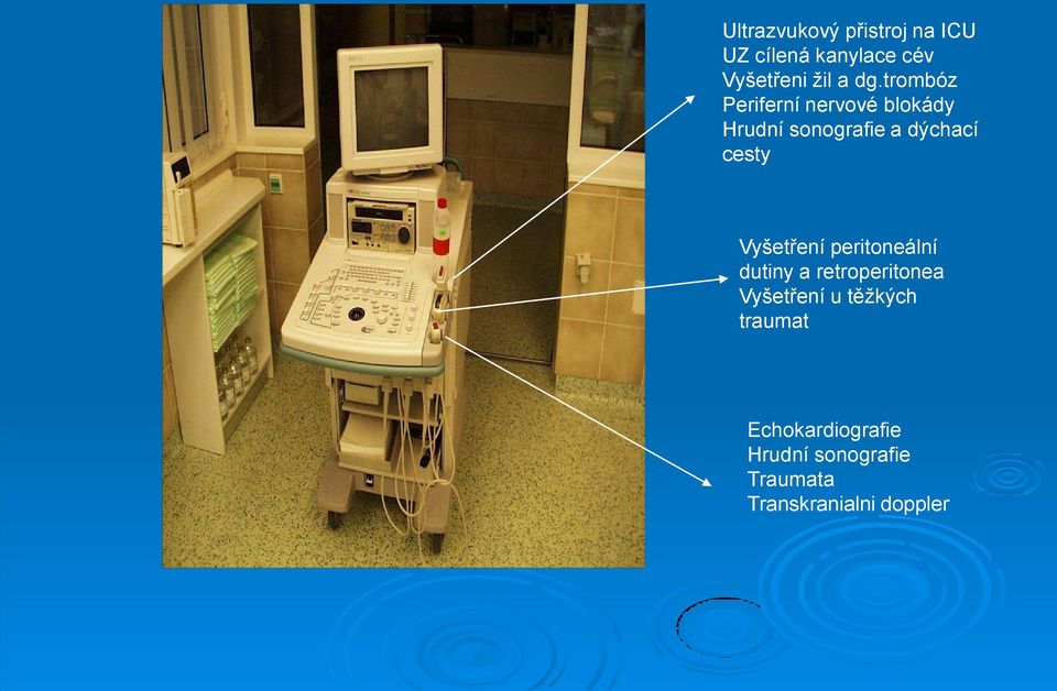 cesty Vyšetření peritoneální dutiny a retroperitonea Vyšetření u