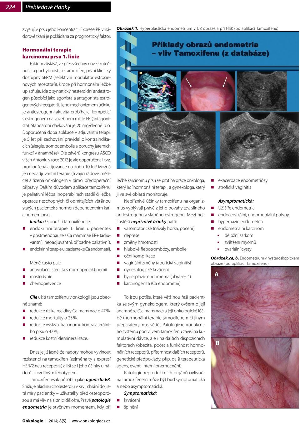 linie Faktem zůstává, že přes všechny nové skutečnosti a pochybnosti se tamoxifen, první klinicky dostupný SERM (selektivní modulátor estrogenových receptorů), široce při hormonální léčbě uplatňuje.