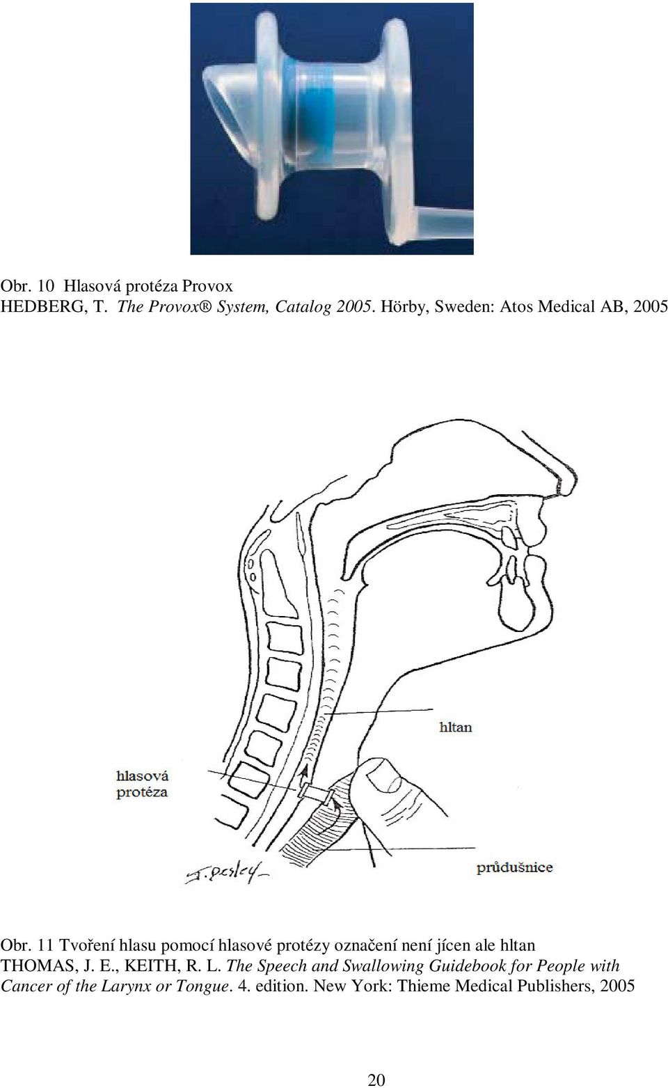 11 Tvoení hlasu pomocí hlasové protézy oznaení není jícen ale hltan THOMAS, J. E.