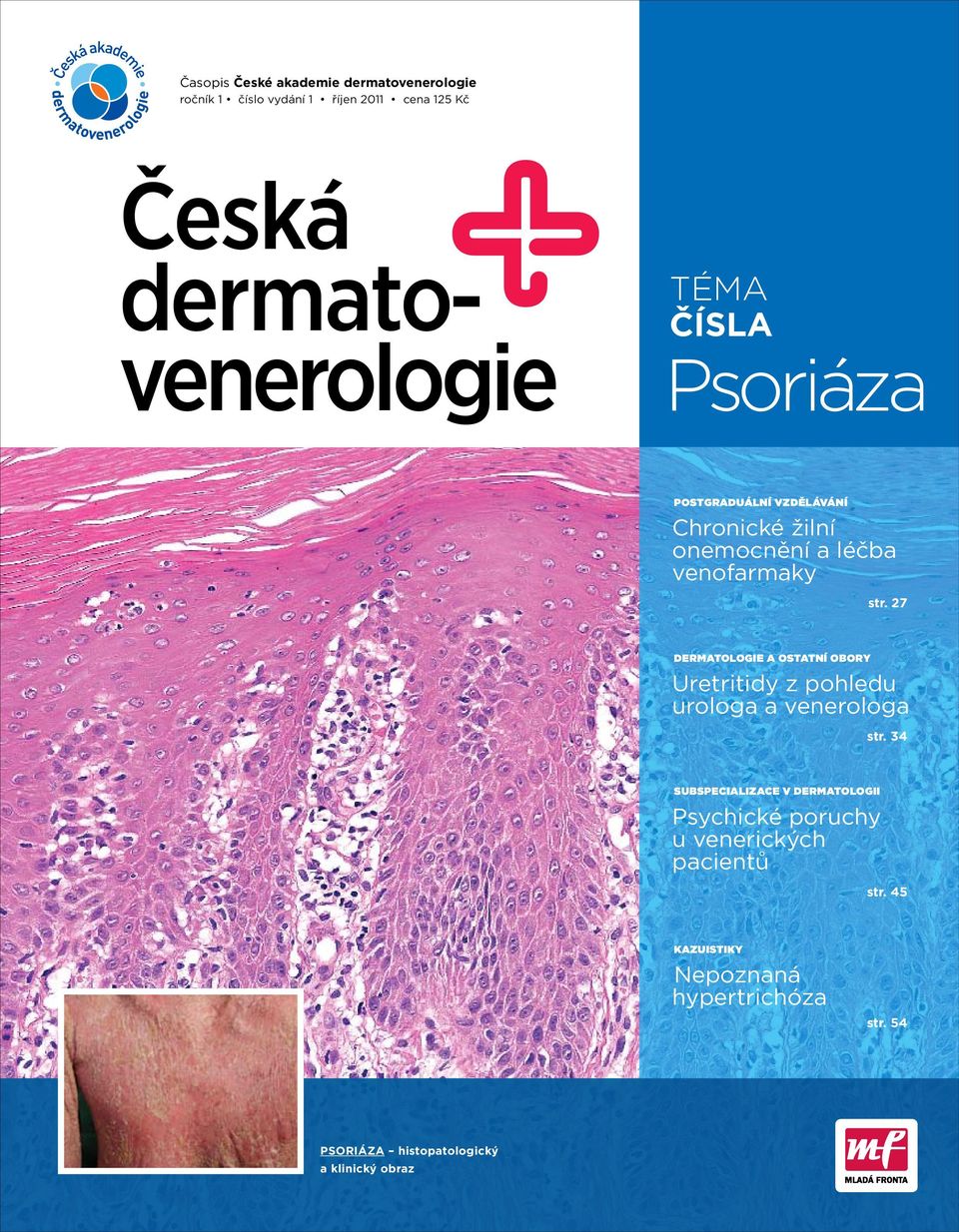 27 Dermatologie a ostatní obory Uretritidy z pohledu urologa a venerologa str.