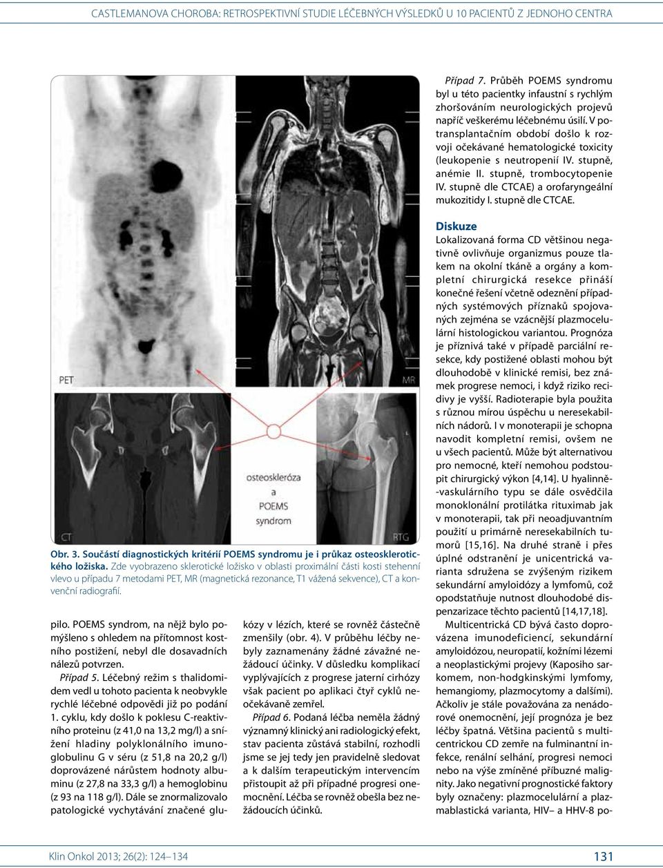 stupně dle CTCAE. Obr. 3. Součástí diagnostických kritérií POEMS syndromu je i průkaz osteosklerotického ložiska.