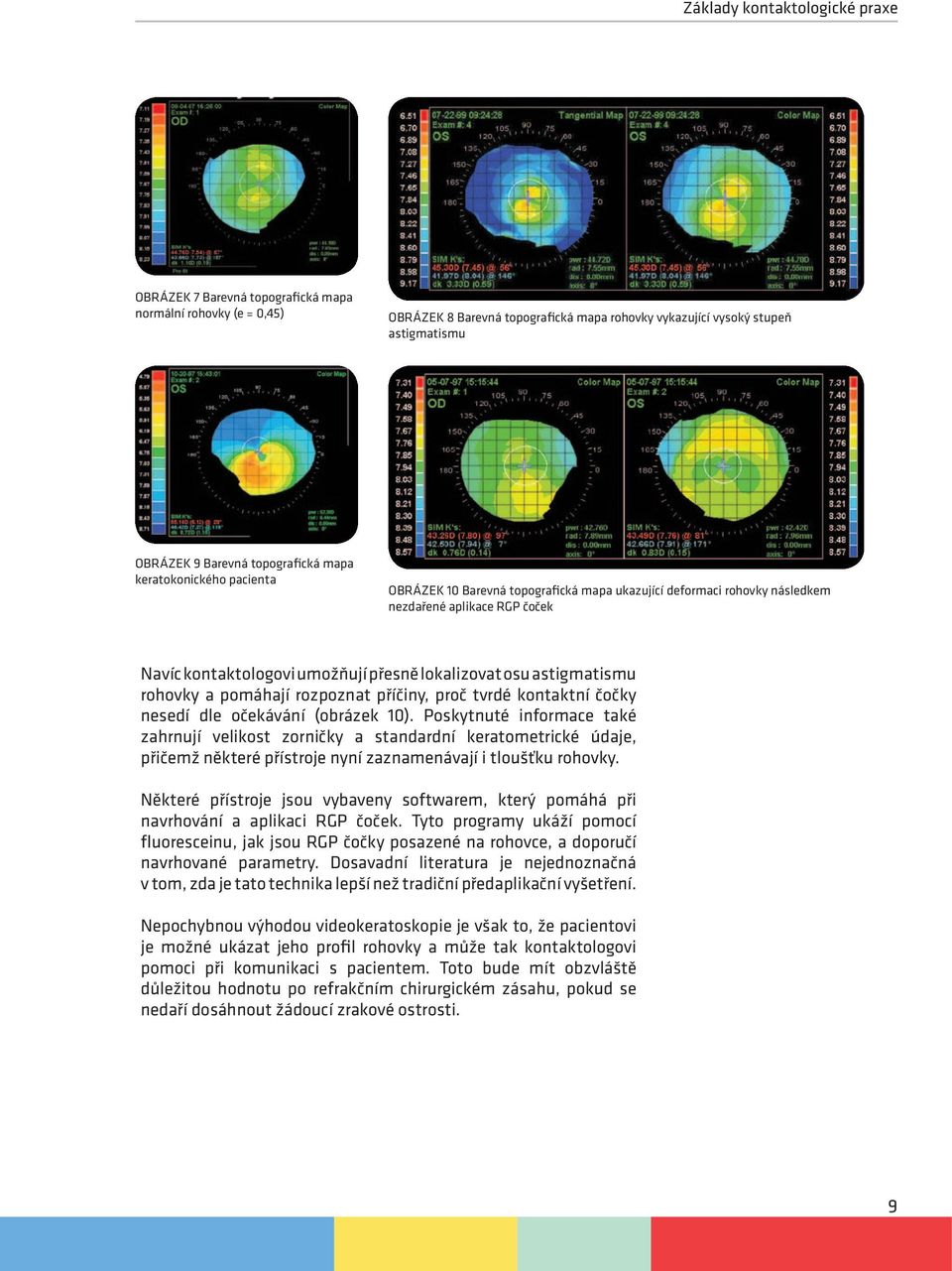 astigmatismu rohovky a pomáhají rozpoznat příčiny, proč tvrdé kontaktní čočky nesedí dle očekávání (obrázek 10).