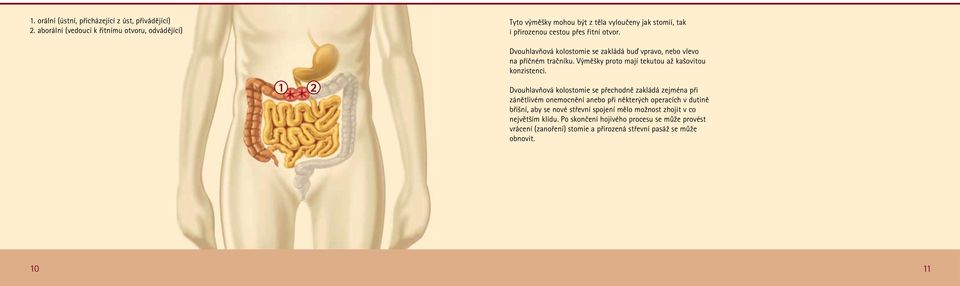 1 2 Dvouhlavňová kolostomie se zakládá buď vpravo, nebo vlevo na příčném tračníku. Výměšky proto mají tekutou až kašovitou konzistenci.