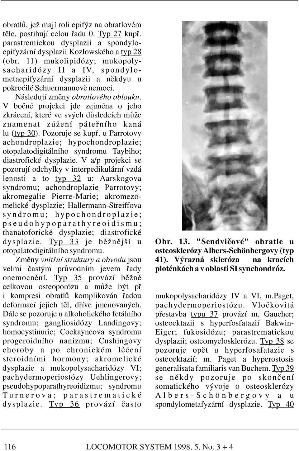 V bočné projekci jde zejména o jeho zkrácení, které ve svých důsledcích může znamenat zúžení páteřního kaná lu (typ 30). Pozoruje se kupř.