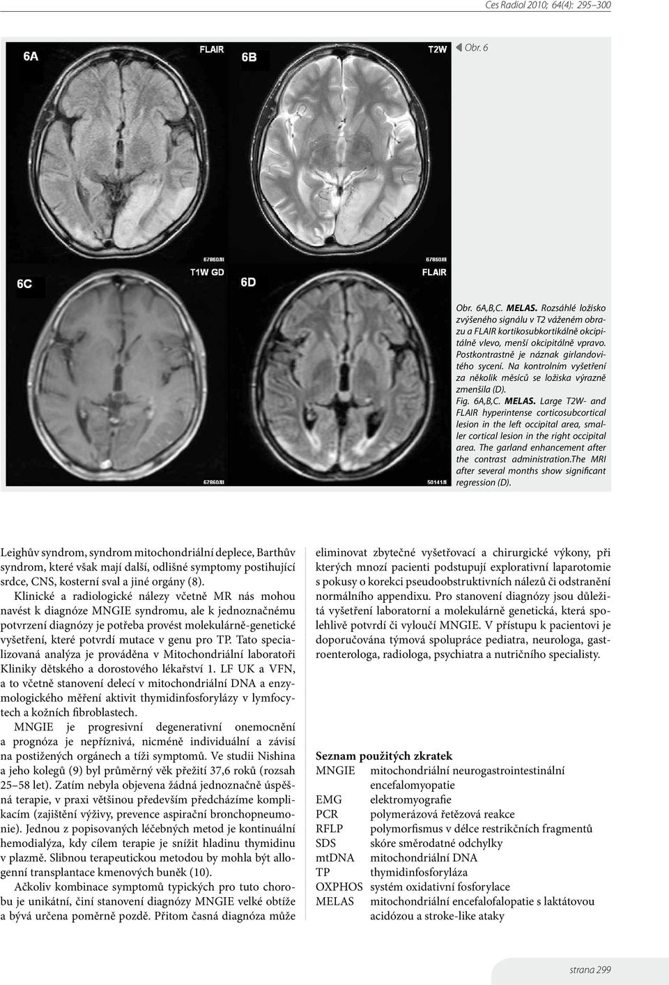 Large T2W- and FLAIR hyperintense corticosubcortical lesion in the left occipital area, smaller cortical lesion in the right occipital area. The garland enhancement after the contrast administration.