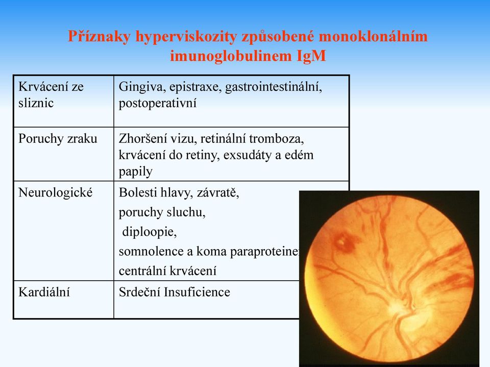 vizu, retinální tromboza, krvácení do retiny, exsudáty a edém papily Bolesti hlavy, závratě,