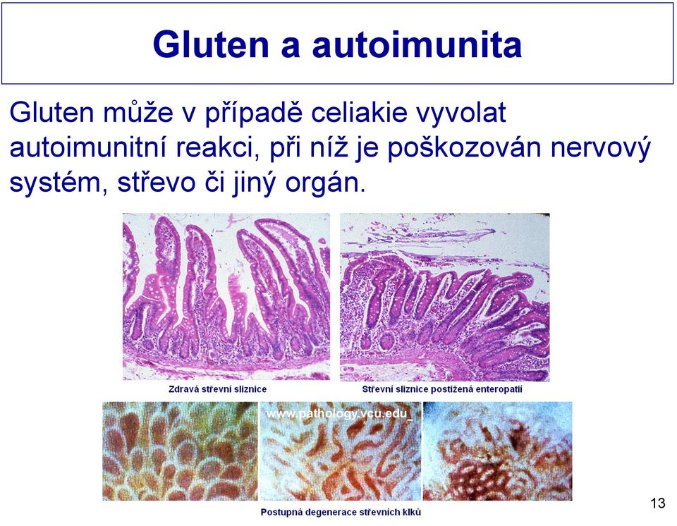 reakci, při níž je poškozován nervový