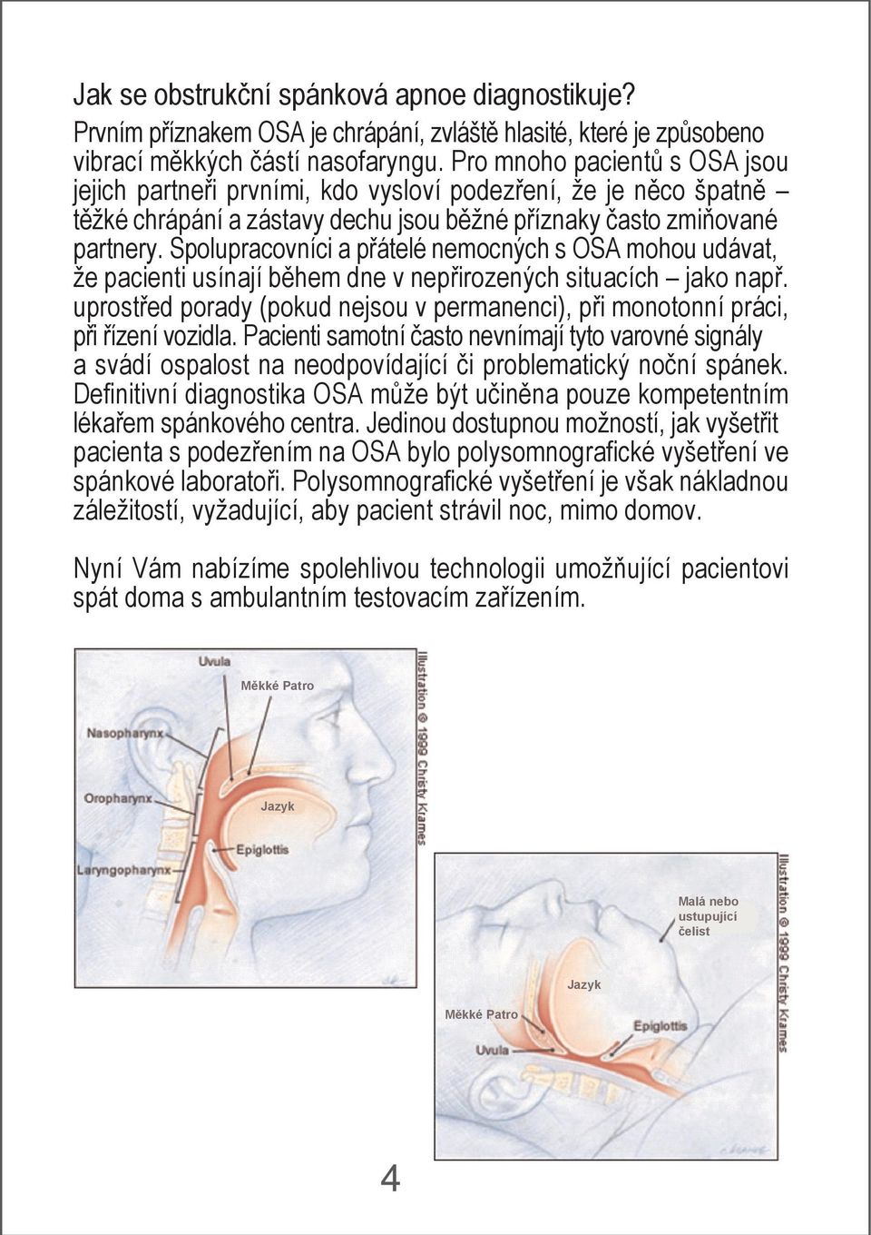 Spolupracovníci a přátelé nemocných s OSA mohou udávat, že pacienti usínají během dne v nepřirozených situacích jako např.