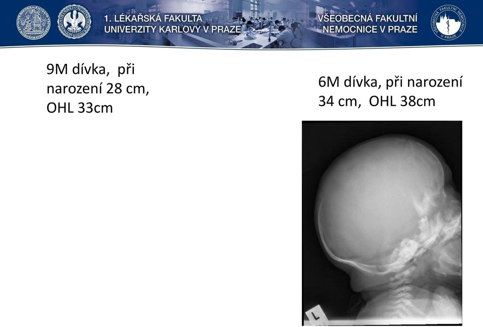 33cm 6M dívka, při