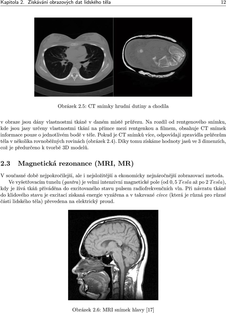 Pokud je CT snímků více, odpovídají zpravidla průřezům těla v několika rovnoběžných rovinách (obrázek 2.