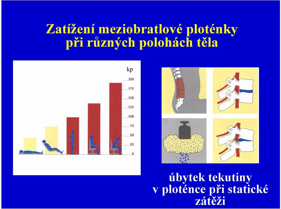 Zatížení meziobratlové