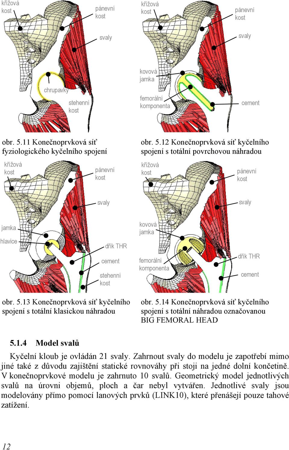 12 Konečnoprvková síť kyčelního spojení s totální povrchovou náhradou křížová kost pánevní kost svaly svaly jamka hlavice dřík THR cement stehenní kost kovová jamka femorální komponenta dřík THR