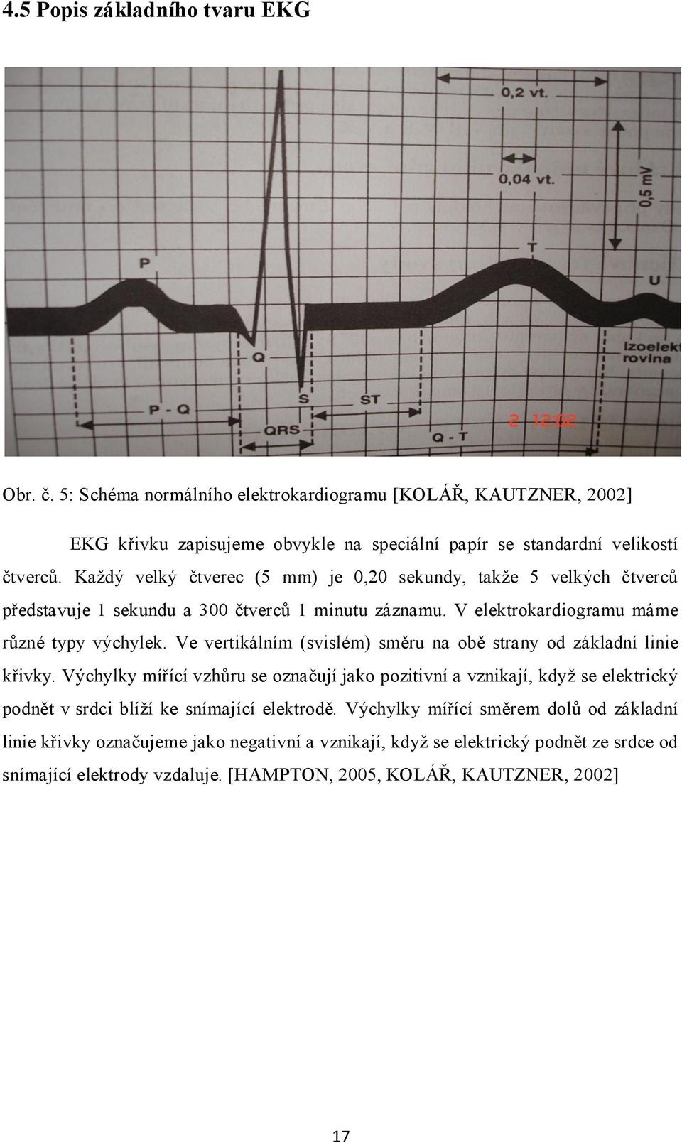 Ve vertikálním (svislém) směru na obě strany od základní linie křivky.