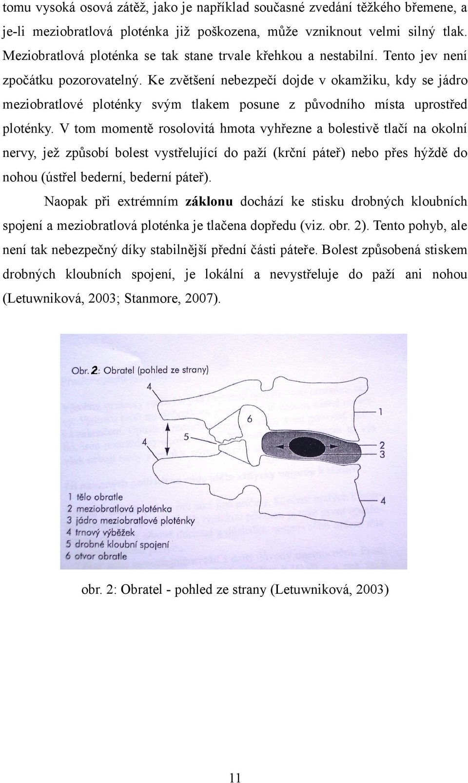 Ke zvětšení nebezpečí dojde v okamžiku, kdy se jádro meziobratlové ploténky svým tlakem posune z původního místa uprostřed ploténky.