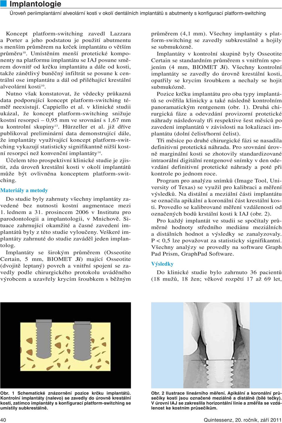 implantátu a dál od přiléhající krestální alveolární kosti 10. Nutno však konstatovat, že vědecky průkazná data podporující koncept platform-switching téměř neexistují. Cappiello et al.