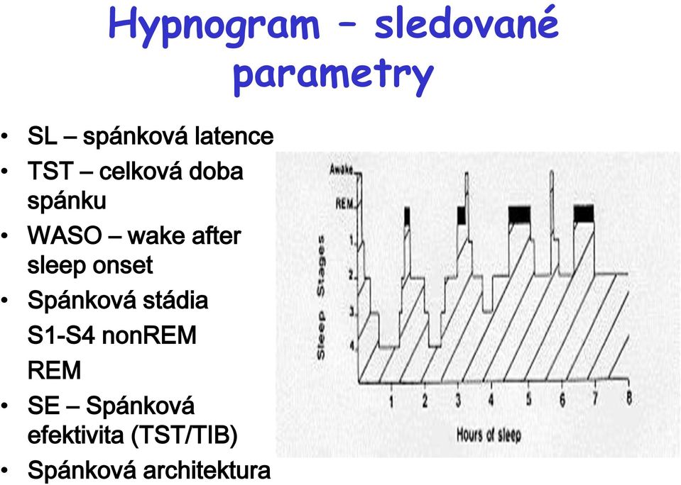 Spánková stádia S1-S4 nonrem REM SE Spánková