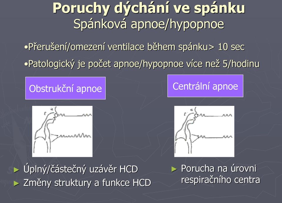 více než 5/hodinu Obstrukční apnoe Centrální apnoe Úplný/částečný