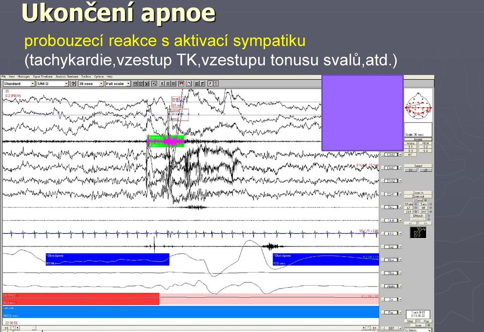 s aktivací sympatiku