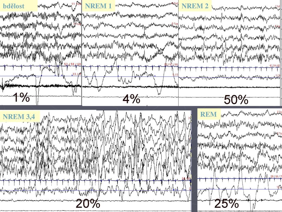 NREM 3,4 4%