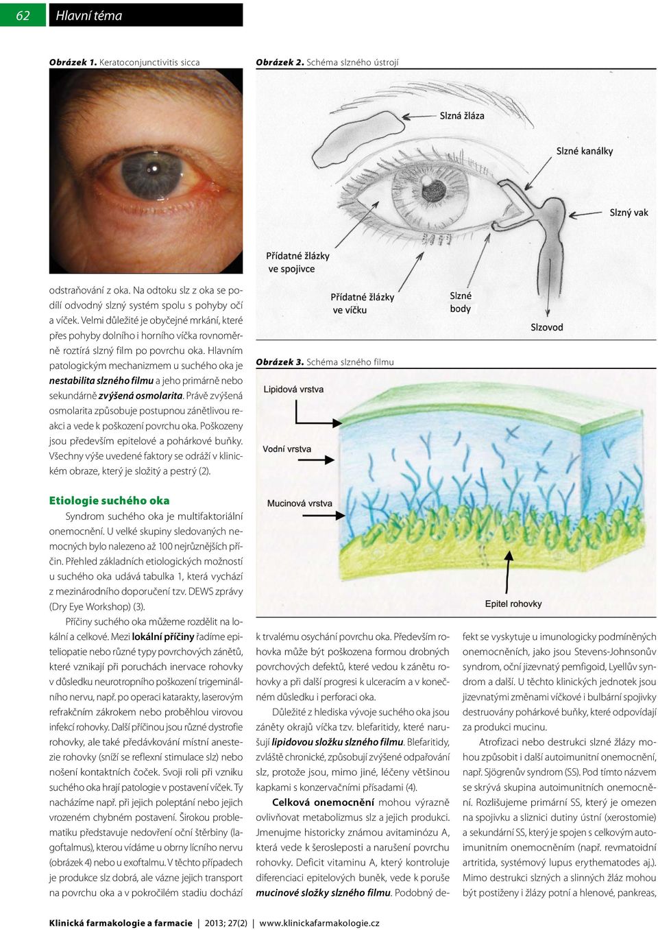 Hlavním patologickým mechanizmem u suchého oka je nestabilita slzného filmu a jeho primárně nebo sekundárně zvýšená osmolarita.