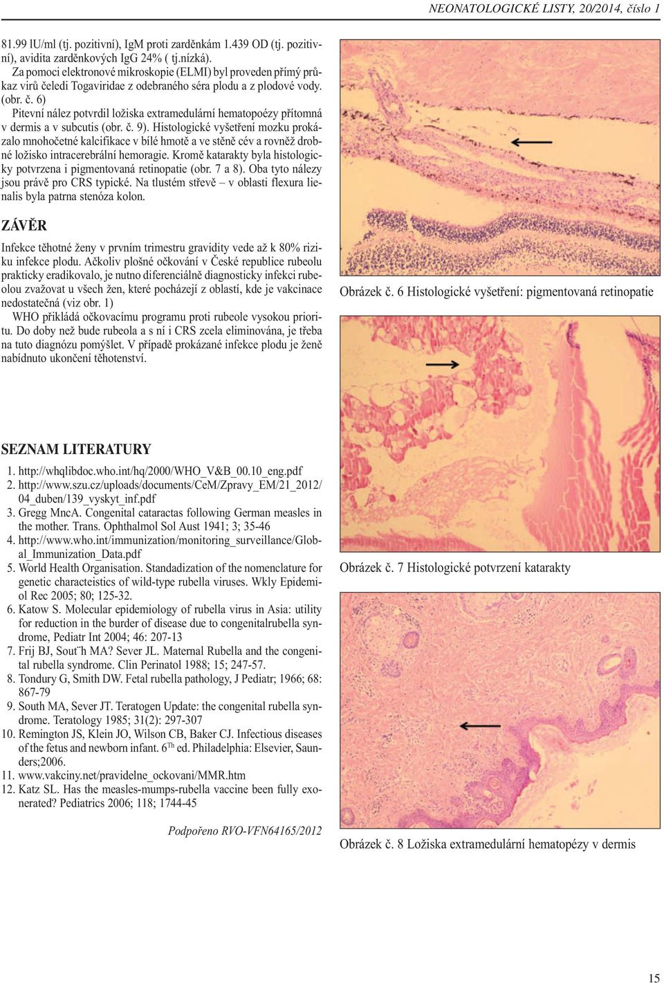 č. 9). Histologické vyšetření mozku prokázalo mnohočetné kalcifikace v bílé hmotě a ve stěně cév a rovněž drobné ložisko intracerebrální hemoragie.