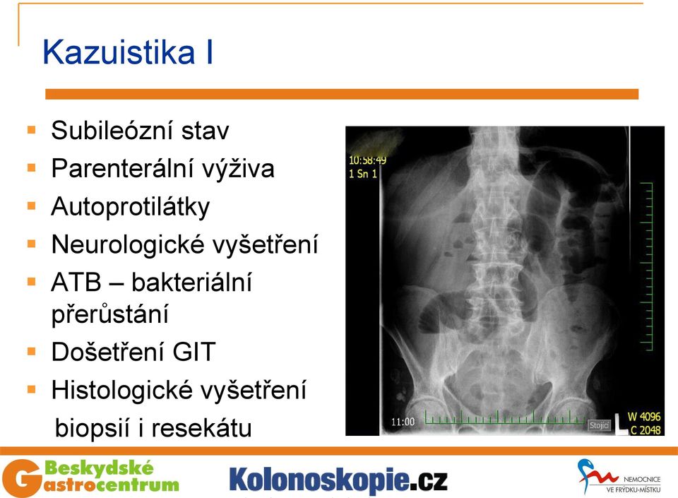 vyšetření ATB bakteriální přerůstání