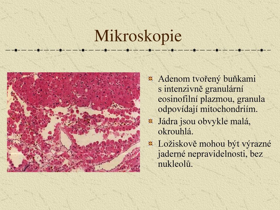 mitochondriím. Jádra jsou obvykle malá, okrouhlá.