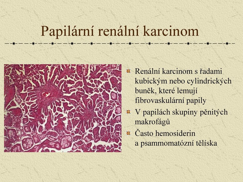 lemují fibrovaskulární papily V papilách skupiny