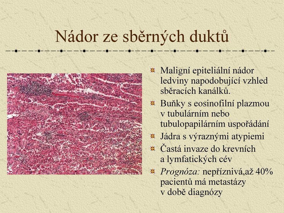 Buňky s eosinofilní plazmou v tubulárním nebo tubulopapilárním uspořádání