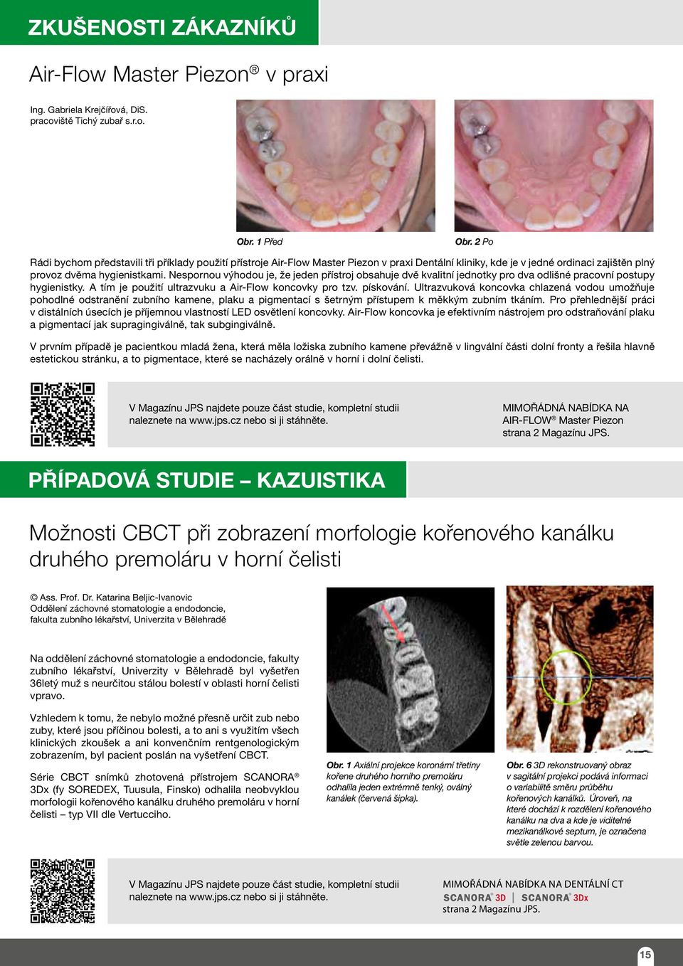 Nespornou výhodou je, že jeden přístroj obsahuje dvě kvalitní jednotky pro dva odlišné pracovní postupy hygienistky. A tím je použití ultrazvuku a Air-Flow koncovky pro tzv. pískování.