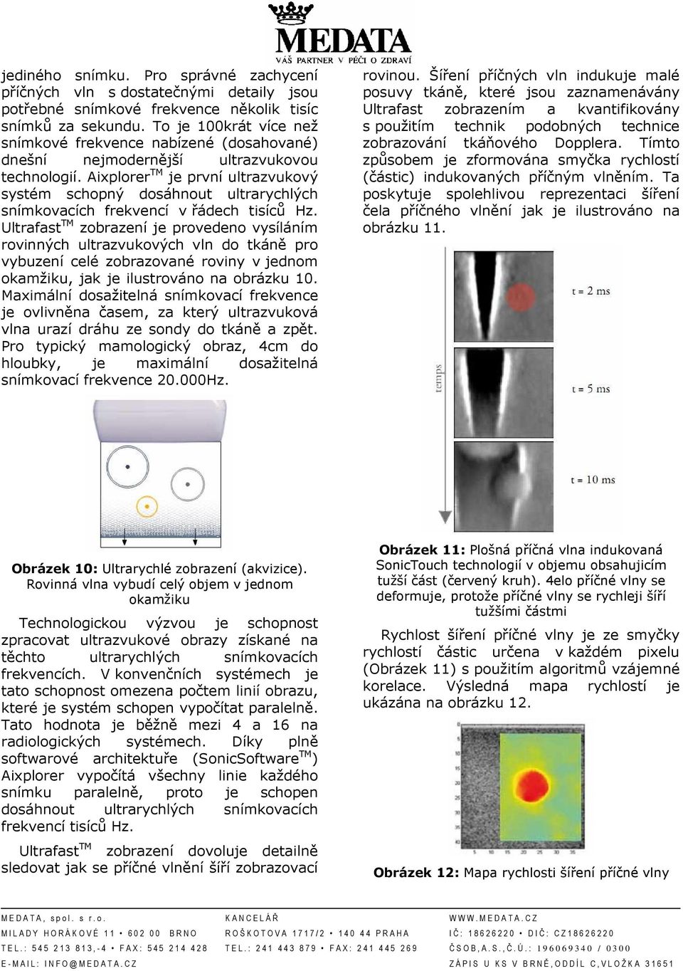 Aixplorer TM je první ultrazvukový systém schopný dosáhnout ultrarychlých snímkovacích frekvencí v řádech tisíců Hz.