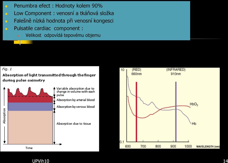 při venosní kongesci Pulsatile cardiac component