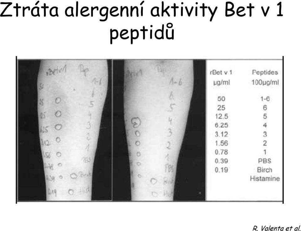 aktivity Bet v