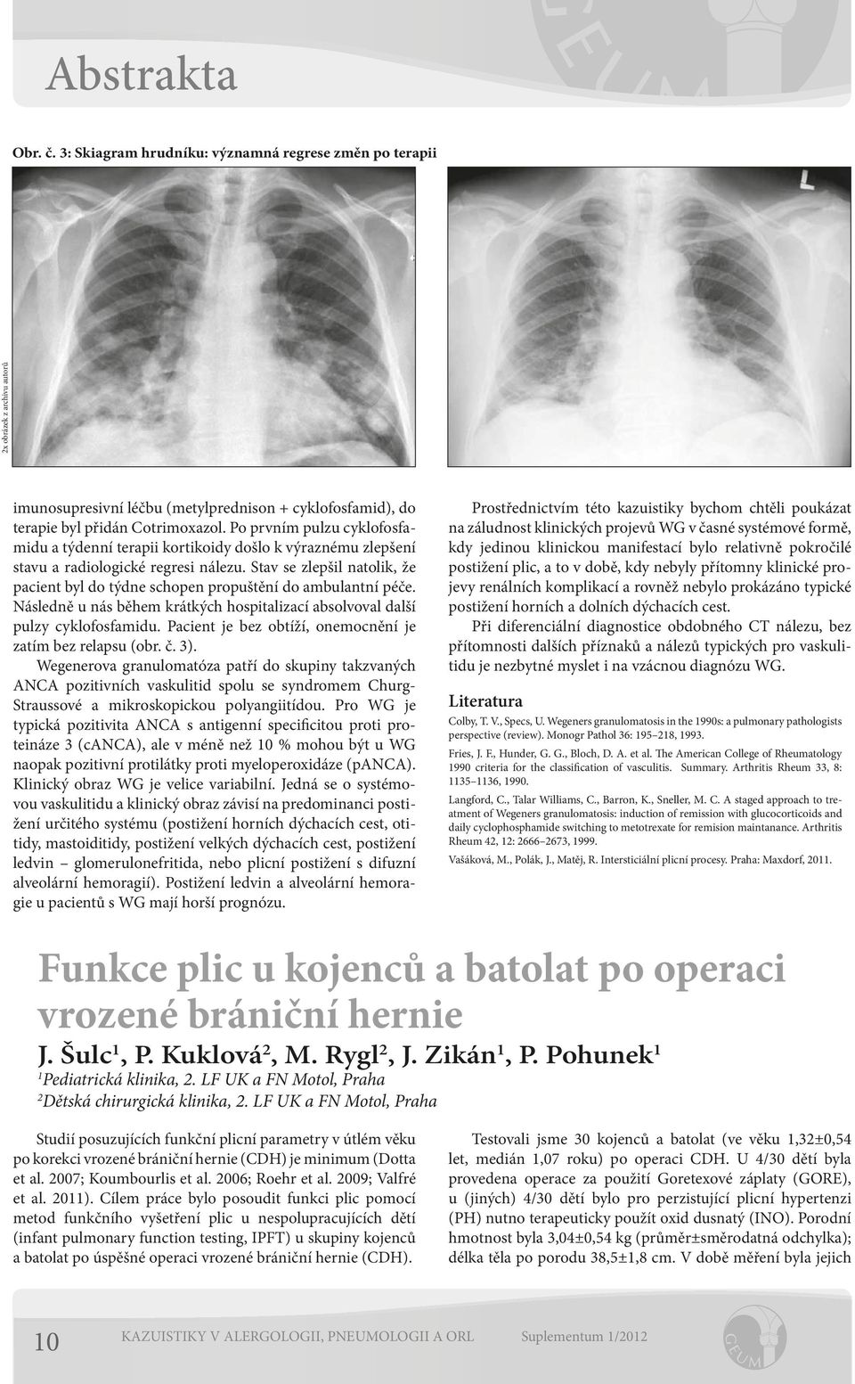 Stav se zlepšil natolik, že pacient byl do týdne schopen propuštění do ambulantní péče. Následně u nás během krátkých hospitalizací absolvoval další pulzy cyklofosfamidu.