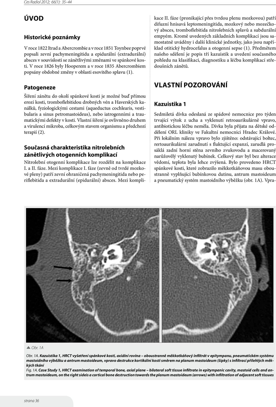 Patogeneze Šíření zánětu do okolí spánkové kosti je možné buď přímou erozí kosti, tromboflebitidou drobných vén a Haverských kanálků, fyziologickými cestami (aqueductus cochlearis, vestibularis a