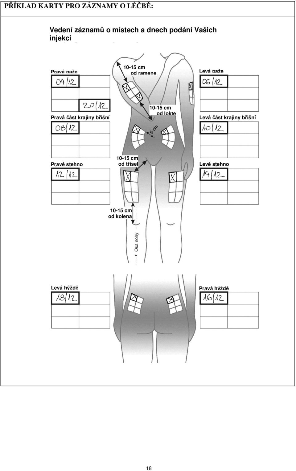 krajiny břišní 10-15 cm od lokte Levá část krajiny břišní Pravé stehno