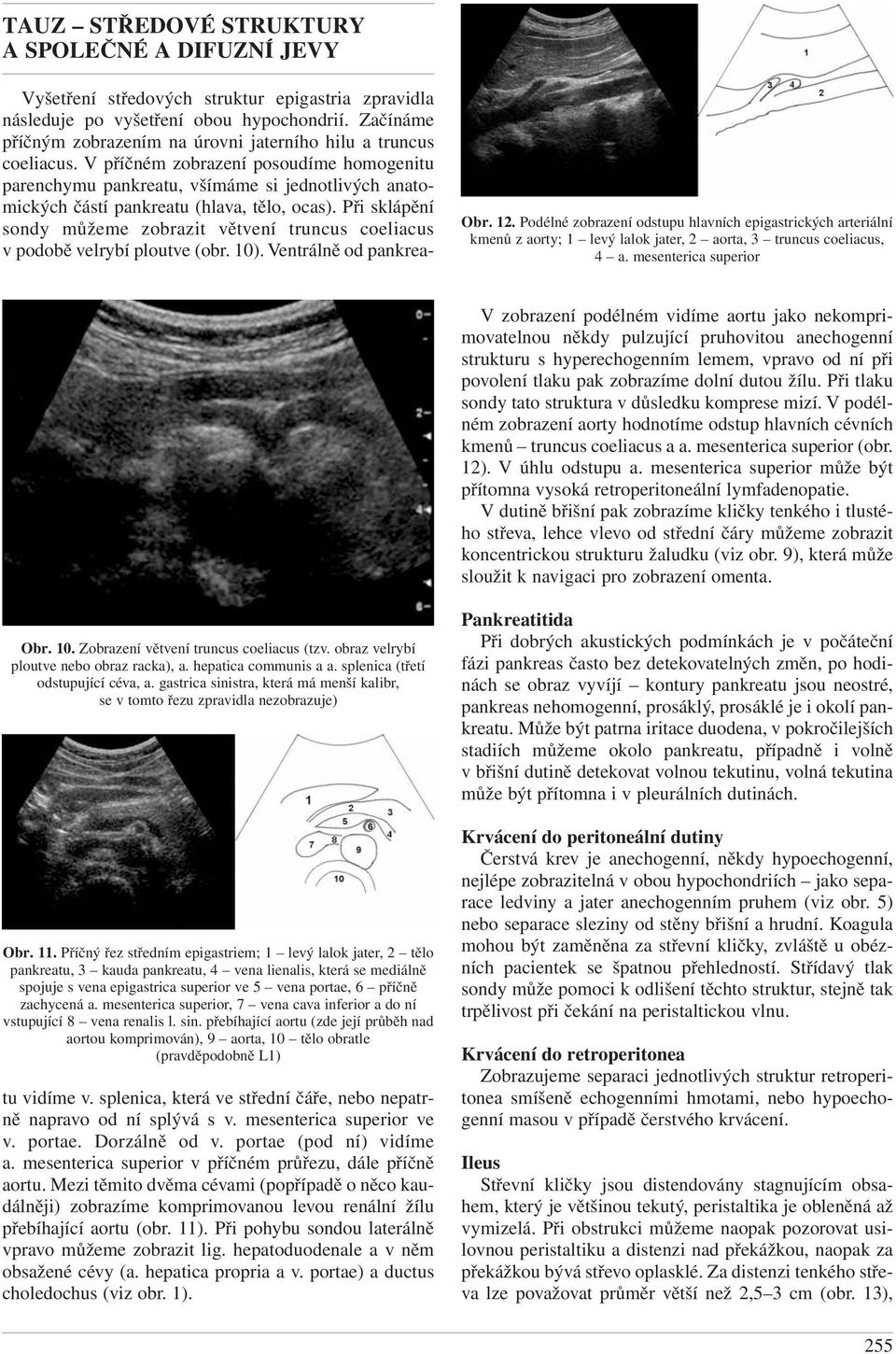 dolní dutou žílu. Při tlaku sondy tato struktura v důsledku komprese mizí. V podélném zobrazení aorty hodnotíme odstup hlavních cévních kmenů truncus coeliacus a a. mesenterica superior (obr. 12).