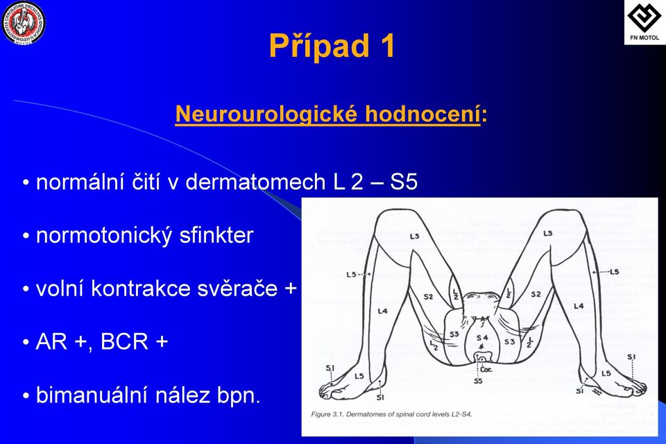 normotonický sfinkter volní kontrakce