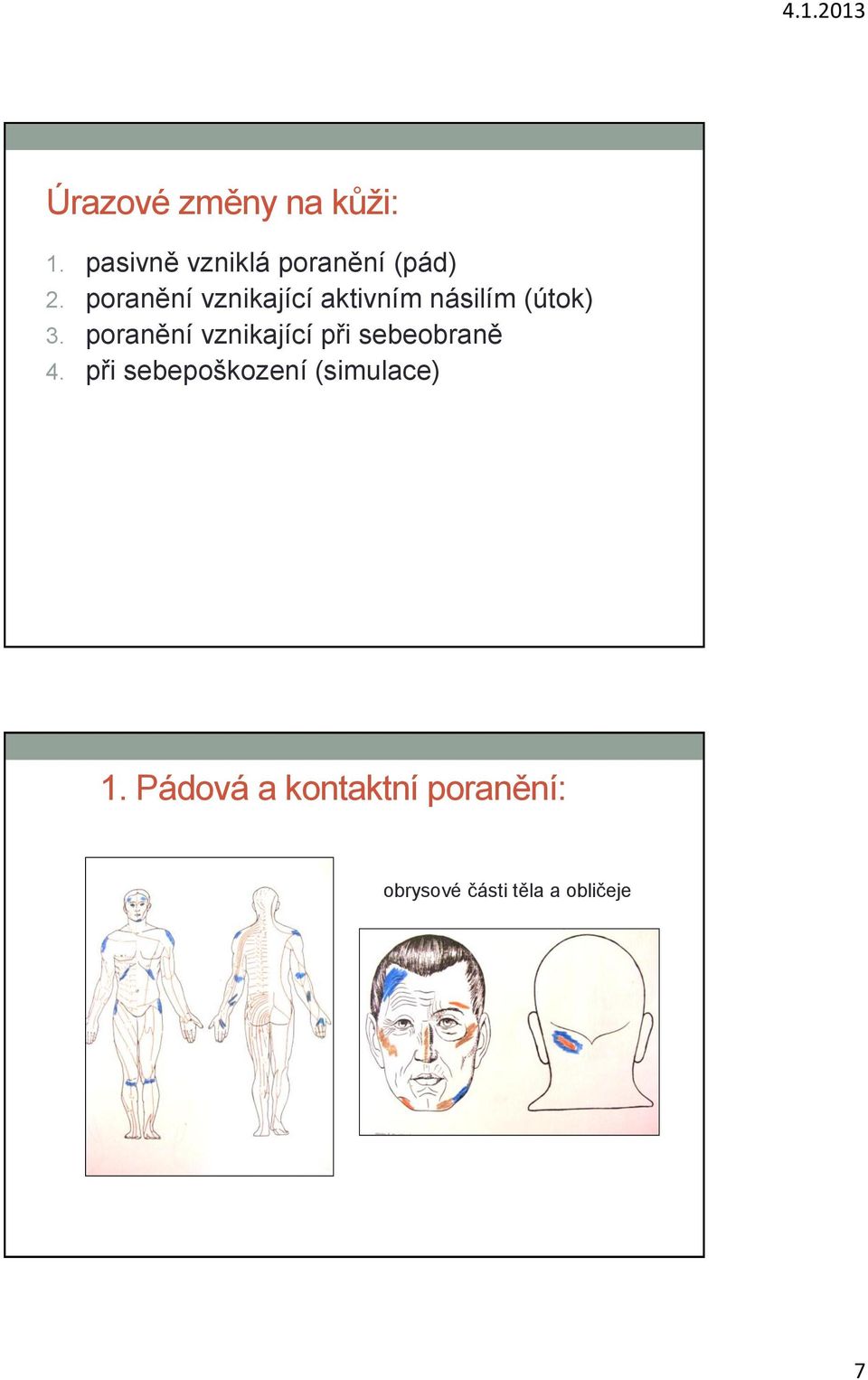 poranění vznikající při sebeobraně 4.