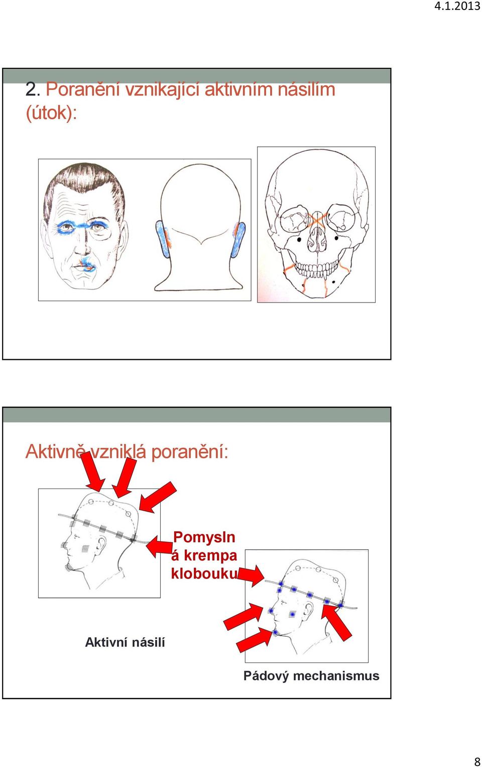 poranění: Pomysln á krempa