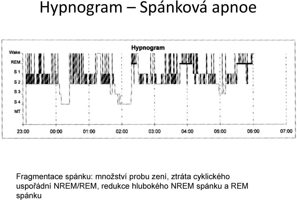 cyklického uspořádní NREM/REM,