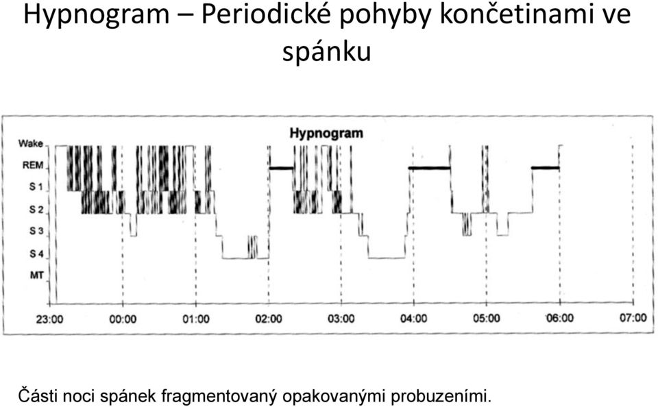 spánku Části noci spánek