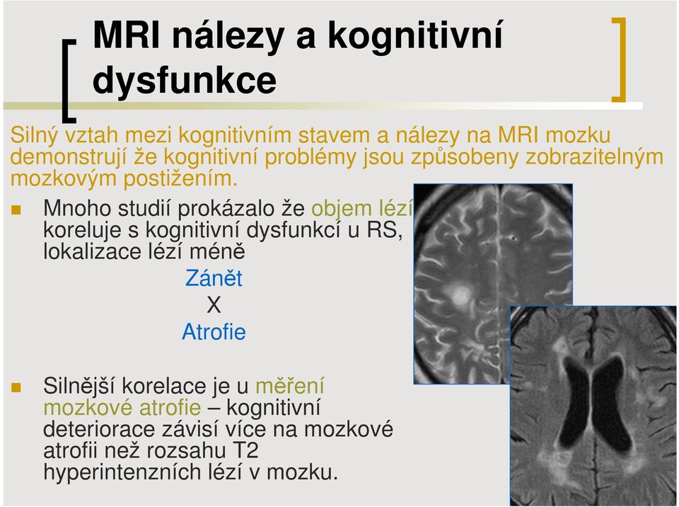 Mnoho studií prokázalo že objem lézí koreluje s kognitivní dysfunkcí u RS, lokalizace lézí méně Zánět X