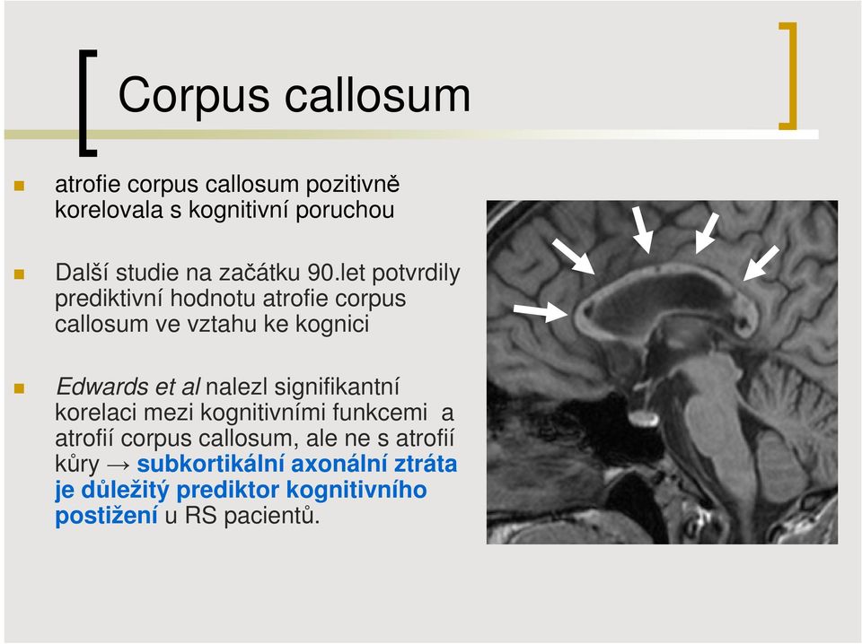 let potvrdily prediktivní hodnotu atrofie corpus callosum ve vztahu ke kognici Edwards et al nalezl