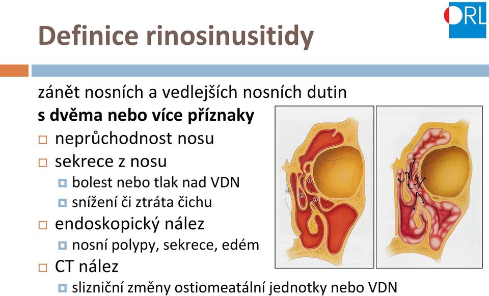 nebo tlak nad VDN snížení či ztráta čichu endoskopický nález nosní