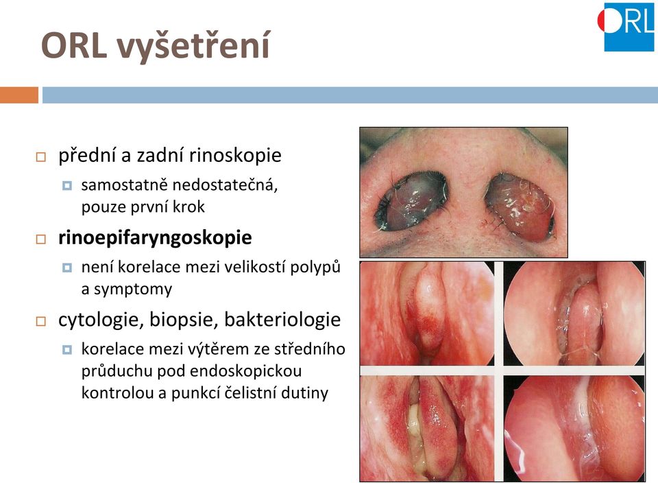 polypů a symptomy cytologie, biopsie, bakteriologie korelace mezi