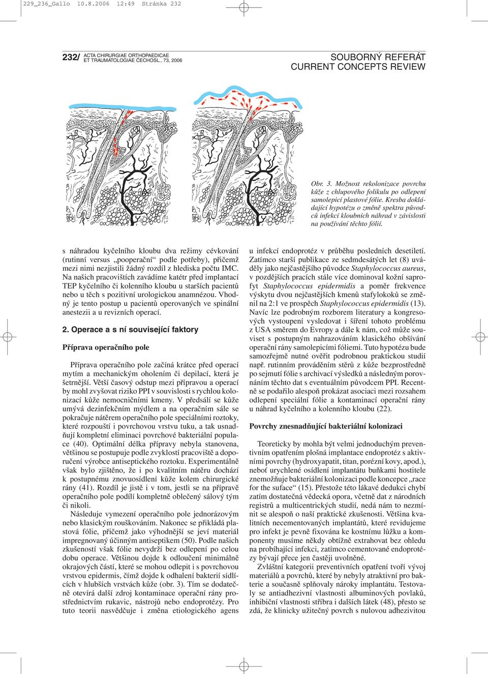 s náhradou kyčelního kloubu dva režimy cévkování (rutinní versus pooperační podle potřeby), přičemž mezi nimi nezjistili žádný rozdíl z hlediska počtu IMC.