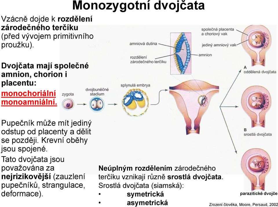 Pupečník může mít jediný odstup od placenty a dělit se později. Krevní oběhy jsou spojené.