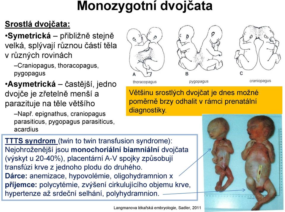 epignathus, craniopagus parasiticus, pygopagus parasiticus, acardius Většinu srostlých dvojčat je dnes možné poměrně brzy odhalit v rámci prenatální diagnostiky.